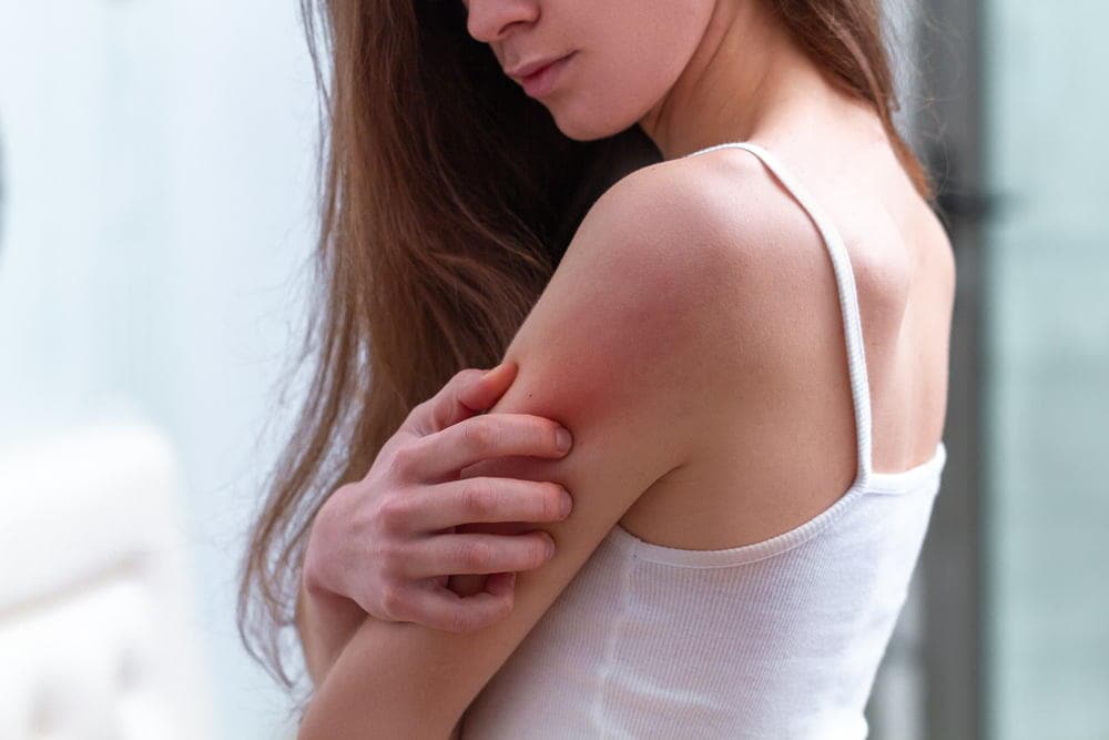 moisturizer-for-sensitive-skin